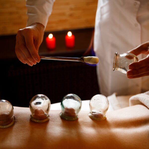 Acupuncture